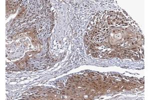 Immunohistochemistry (IHC) image for anti-NSFL1 (p97) Cofactor (p47) (NSFL1C) (Center) antibody (ABIN2856019)