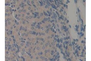 Detection of REG3b in Mouse Ovary Tissue using Polyclonal Antibody to Regenerating Islet Derived Protein 3 Beta (REG3b)