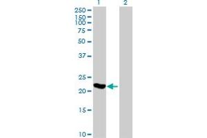 Western Blot analysis of ARL3 expression in transfected 293T cell line by ARL3 MaxPab polyclonal antibody. (ARL3 抗体  (AA 1-182))