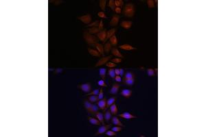 Immunofluorescence analysis of HeLa cells using Presenilin 1 Rabbit pAb (ABIN3023159, ABIN3023160, ABIN3023161 and ABIN6219418) at dilution of 1:100 (40x lens).