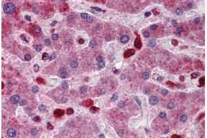 Human Liver: Formalin-Fixed, Paraffin-Embedded (FFPE) (ACP2 抗体  (AA 144-193))