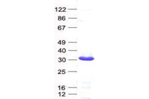 Validation with Western Blot (UBE2E3 Protein (His tag))