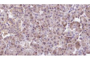 Immunohistochemistry (IHC) image for anti-Dynein, Cytoplasmic 2, Light Intermediate Chain 1 (DYNC2LI1) (Internal Region) antibody (ABIN6261393)