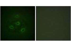 Immunofluorescence analysis of HepG2 cells, using PP2A-alpha (Ab-307) Antibody. (PPP2CA 抗体  (AA 260-309))