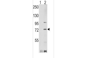 Western blot analysis of K1 (arrow) using rabbit polyclonal K1 Antibody  (ABIN392432 and ABIN2842032). (PAK1 抗体  (AA 401-430))