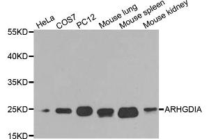 Western blot analysis of extracts of various cell lines, using ARHGDIA antibody (ABIN5970556) at 1/1000 dilution. (ARHGDIA 抗体)
