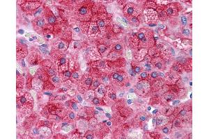 ApoE antibody was used for immunohistochemistry at a concentration of 4-8 ug/ml. (APOE 抗体  (N-Term))