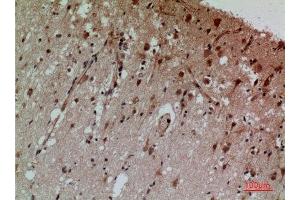 Immunohistochemistry (IHC) analysis of paraffin-embedded Human Brain, antibody was diluted at 1:100. (CD58 抗体  (Internal Region))