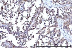 IHC analysis of RANBP2 using anti-RANBP2 antibody (ABIN7602650). (RANBP2 抗体  (AA 906-2744))