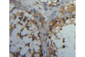 Used in DAB staining on fromalin fixed paraffin-embedded testis tissue (CA5B 抗体  (AA 34-317))
