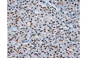 Immunohistochemical staining of paraffin-embedded lung tissue using anti-DAPK2 mouse monoclonal antibody. (DAPK2 抗体)