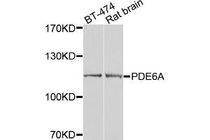 Western blot analysis of extracts of various cell lines, using PDE6A antibody (ABIN5974769) at 1/1000 dilution. (PDE6A 抗体)