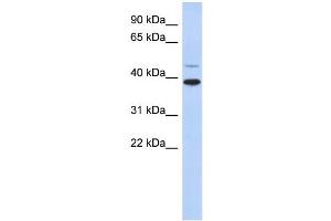 WB Suggested Anti-RNF121 Antibody Titration:  0. (RNF121 抗体  (Middle Region))