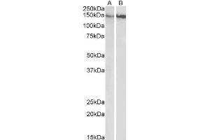 ABIN5539624 (0. (ITGB1 抗体  (Internal Region))