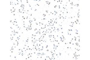 Immunocytochemistry (ICC) image for anti-AT Rich Interactive Domain 1A (SWI-Like) (ARID1A) (AA 750-800) antibody (ABIN7795677)