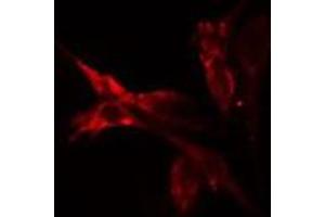 ABIN6275501 staining HeLa cells by IF/ICC. (ARHGEF2 抗体  (C-Term))