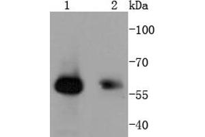 Lane 1: Human skeletal muscle, Lane 2: Hela, probed with HDAC2 (3B7) Monoclonal Antibody  at 1:1000 overnight at 4˚C. (SMAD1 抗体)