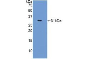 Western blot analysis of recombinant Human CENPI. (CENPI 抗体  (AA 292-528))