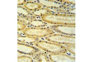Immunohistochemistry analysis in formalin fixed and paraffin embedded lung tissue reacted with 17-beta-HSD11 / HSD17B11 Antibody (N-term) followed which was peroxidase conjugated to the secondary antibody and followed by DAB staining. (HSD17B11 抗体  (N-Term))