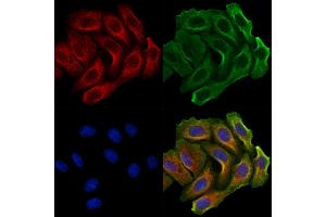 ABIN7094247 and ABIN7098294 staining Hela cells by IF/ICC. (GALNT14 抗体  (N-Term))