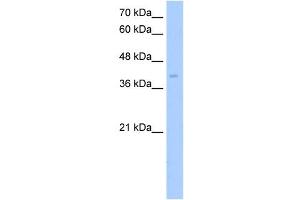 ZDHHC17 antibody used at 5 ug/ml to detect target protein. (ZDHHC17 抗体  (Middle Region))