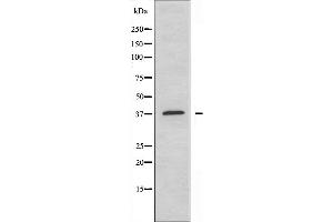 Western blot analysis of extracts from HeLa cells using ARG2 antibody. (ARG2 抗体  (C-Term))