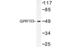 Image no. 1 for anti-Pyroglutamylated RFamide Peptide Receptor (QRFPR) antibody (ABIN317864) (QRFPR 抗体)
