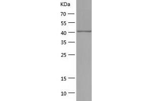 Western Blotting (WB) image for phosphoribosylaminoimidazole Carboxylase, phosphoribosylaminoimidazole Succinocarboxamide Synthetase (PAICS) (AA 1-425) protein (His tag) (ABIN7124444) (PAICS Protein (AA 1-425) (His tag))