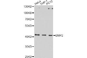 Western blot analysis of extracts of various cell lines, using BMP2 Antibody. (BMP2 抗体)
