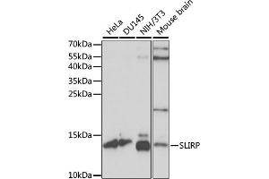 Western blot analysis of extracts of various cell lines, using SLIRP antibody (ABIN7270560) at 1:1000 dilution.