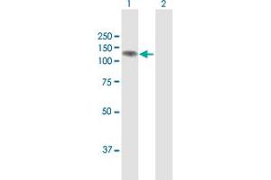 Western Blot analysis of PHC1 expression in transfected 293T cell line by PHC1 MaxPab polyclonal antibody. (PHC1 抗体  (AA 1-957))
