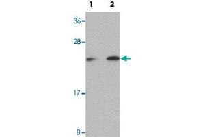 Western blot analysis of Raji cells with LIN28 polyclonal antibody  at (Lane 1) 1 and (Lane 2) 2 ug/mL dilution. (LIN28A 抗体  (C-Term))