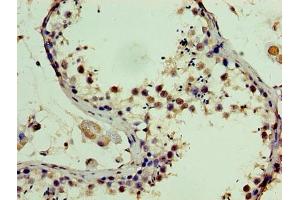Immunohistochemistry of paraffin-embedded human testis tissue using ABIN7169765 at dilution of 1:100 (SSSCA1 抗体  (AA 2-199))