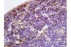 Formalin-fixed and paraffin embedded mouse spleen labeled with Anti-ATH III/Antithrombin III Polyclonal Antibody, Unconjugated (ABIN732323) at 1:200 followed by conjugation to the secondary antibody and DAB staining (SERPINC1 抗体  (AA 141-211))