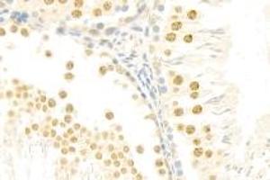 Immunohistochemistry analysis of paraffin-embedded rat testis using mSin3A (ABIN7075609) at dilution of 1: 100