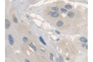 Immunohistochemistry (IHC) image for anti-Anthrax Toxin Receptor 2 (ANTXR2) (AA 34-318) antibody (ABIN7435958)