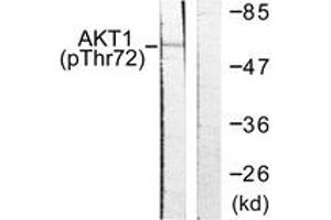 Western blot analysis of extracts from NIH-3T3 cells treated with TNF-a 20ng/ml 30', using Akt (Phospho-Thr72) Antibody.