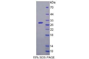 SDS-PAGE analysis of Mouse GCPII Protein. (PSMA 蛋白)