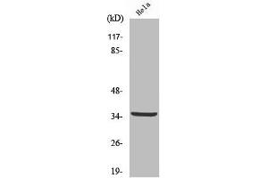 Western Blot analysis of HeLa cells using Cleaved-Cathepsin L2 (L114) Polyclonal Antibody (Cathepsin L2 抗体  (Cleaved-Leu114))