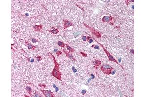 Immunohistochemistry (IHC) image for anti-Potassium Voltage-Gated Channel, Subfamily H (Eag-Related), Member 2 (KCNH2) (Internal Region) antibody (ABIN1048985)