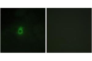 Immunofluorescence analysis of HepG2 cells, using Cytochrome P450 2E1 Antibody. (CYP2E1 抗体  (AA 371-420))