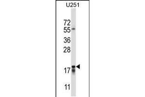 Western blot analysis in U251 cell line lysates (35ug/lane). (CTAG2 抗体  (AA 122-149))