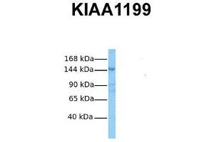Host:  Rabbit  Target Name:  KIAA1199  Sample Tissue:  Human OVCAR-3  Antibody Dilution:  1. (CEMIP 抗体  (Middle Region))