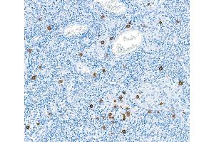 Immunohistochemistry (IHC) image for anti-Granzyme B (GZMB) (AA 19-247) antibody (ABIN7449554) (Recombinant GZMB 抗体  (AA 19-247))