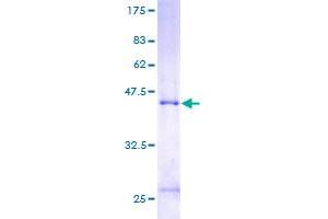 MCTS1 Protein (AA 1-181) (GST tag)