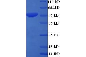 SDS-PAGE (SDS) image for Citrate Synthase (CS) (AA 28-464), (partial) protein (His tag) (ABIN5709331) (CS Protein (AA 28-464, partial) (His tag))