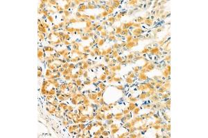 Immunohistochemistry of paraffin embedded rat gastritis using GRASP (ABIN7074140) at dilution of 1:400 (400x lens) (Tamalin/GRASP 抗体)