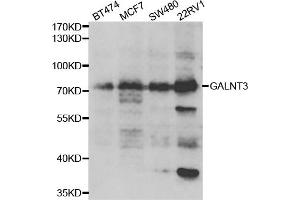 Western blot analysis of extracts of various cell lines, using GALNT3 antibody. (GALNT3 抗体)