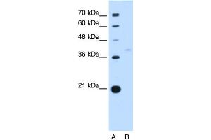 WB Suggested Anti-RFC3 Antibody Titration:  0. (RFC3 抗体  (N-Term))