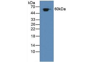 Detection of Hsp60 in Rat Liver Tissue using Polyclonal Antibody to Heat Shock Protein 60 (Hsp60) (HSPD1 抗体  (AA 172-343))